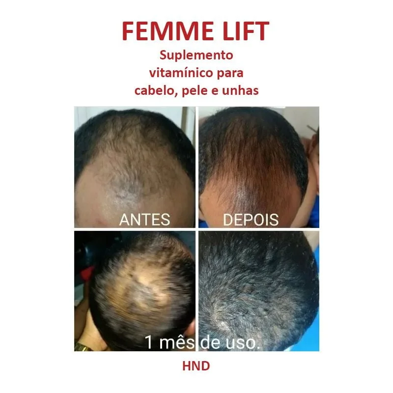 Femme Lift  Suplemento Vitaminico para Cabelo, Pele e Unha