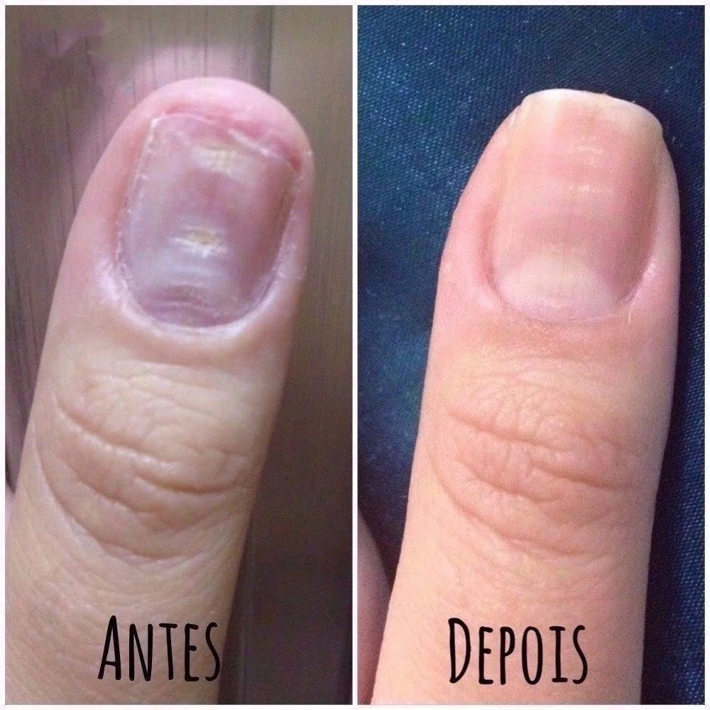 Femme Lift  Suplemento Vitaminico para Cabelo, Pele e Unha